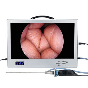 4 इन 1 इंटीग्रेटेड एंडोस्कोप कैमरा सिस्टम ऑल इन वन मेडिकल पोर्टेबल 80w एलईडी कोल्ड लाइट सोर्स एचडी 24 इंच एंडोस्कोप मॉनिटर - Product Image 1