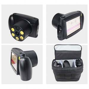 SY-V800 Auto Handheld Optical Instruments Vision Screener Refratômetro Oftalmológico Portátil para Testes Oculares - Product Image 6