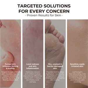 Crema para el Cuidado <span class=keywords><strong>de</strong></span> los Pies para <span class=keywords><strong>Talones</strong></span> Agrietados, Exfoliante, Anti-Grietas, Elimina la Piel Muerta, Repara y Blanquea los Pies - Product Image 4
