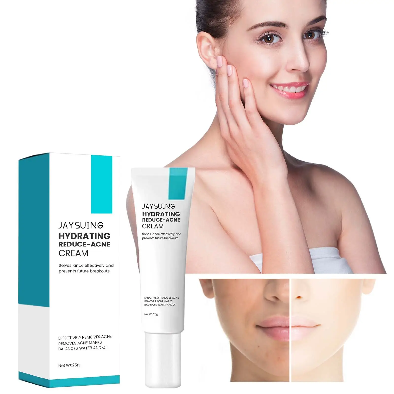 Jaysung cura della pelle sensibile gonfiore della pelle smagliature rimozione sbiancamento anti acne brufolo cicatrice crema per il viso