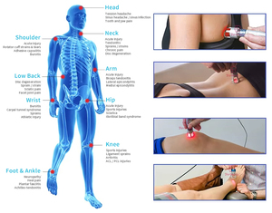 Máquina de Terapia Láser de Clase 4 con Certificación CE MDR, Alivio del Dolor, 650nm 810nm 915nm 1064nm, Equipo de Fisioterapia Láser para Humanos y Mascotas - Product Image 5