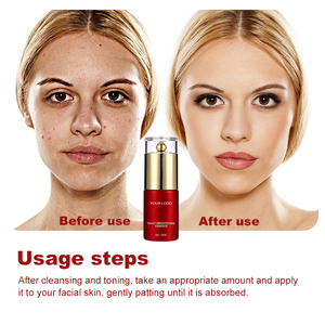 ビフィダ発酵のための抗しわ血清液体式顔の若返りライトニングのための毛穴の強化を浄化する - Product Image 4