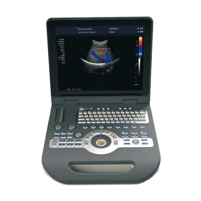 MN-S3500 2024 New medical portable Color Doppler Ultrasound for hospital