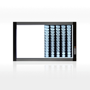 Visor de película ultrafina para Hospital, <span class=keywords><strong>Negatoscopio</strong></span>, lámpara de luz LED DE RAYOS X, Material plástico de energía eléctrica, para uso en el exterior, para uso en el exterior - Product Image 1