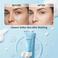 Nettoyant Moussant à l'Aloe Vera et au Beurre de Karité Anti-Acné, Minimiseur de Pores, Contrôle du Sébum, Convient à Tous Types de Peaux
