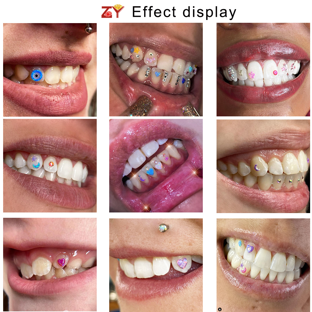 Kit 4 Coppie Cristalli Per Denti - Decorazioni Dentali Con Strass E Pietre Preziose - Foto 8