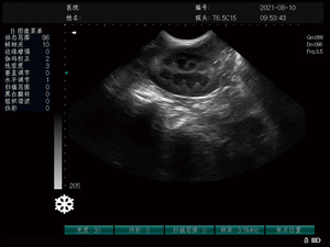 Ecógrafo Veterinario Portátil a Color <span class=keywords><strong>Doppler</strong></span>, Tipo Laptop, Sistema de Ecocardiografía Cardíaca para Hospitales Veterinarios - Product Image 6