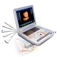 Untuk Mesin USG SUN-800D 3D/4D Human USG Ultrasound dengan Pencitraan 2D/3D Bebas Genggam, Spesialisasi Vaskular OB/GYN, Baterai Terpasang (3