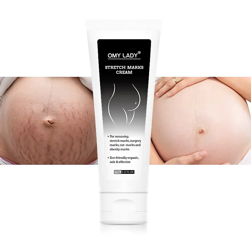 skincare products for stretch marks creams against stretch marks stretch mark cream for legs and thighs