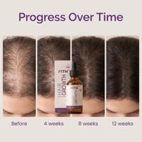 Serum Penumbuh Rambut Biotin Formula Perawatan Kulit Kepala Herbal Bernutrisi OEM Label Pribadi Grosir Massal Bersertifikat GMPC Tanpa Prostaglandin