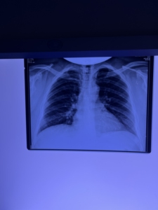 Phim Fuji 3500 Máy In Nhiệt 2000 2000 Lite Phim Nhiệt Y Tế Cho CT DR MRI - Product Image 2