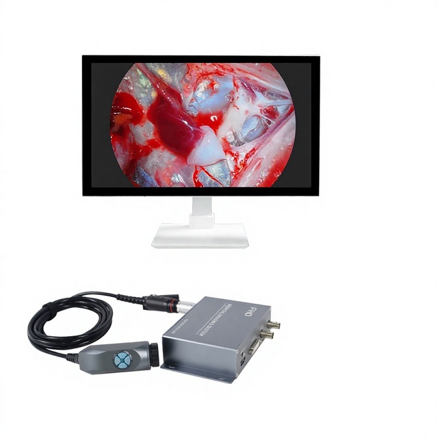 Industrial Endoscopes, Pet Surgery Endoscopes, Portable Integrated Camera Systems, Otolaryngological Endoscopes