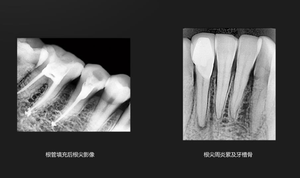 Le cliniche dentali vendono sensori Xpect di grandi dimensioni/tecnologia di Imaging/AI di un secondo. - Product Image 6
