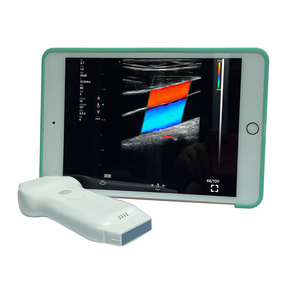 Tragbare drahtlose 2-in-1-Ultraschallsonde mit linearem Hochleistungs-Phased-Array für den klinischen Einsatz - Product Image 2