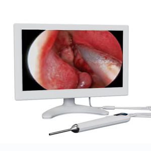 10인치 HD 스크린 이비인후과 내시경 3.9mm 카메라 이경/비경/후두경 충전식 배터리 포함 - Product Image 4