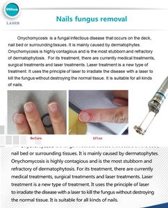 적혈구 제거 모공 클리너 주름 제거제 손 AU 용 5-in-1 홍반 방지 혈관 기계 - Product Image 3