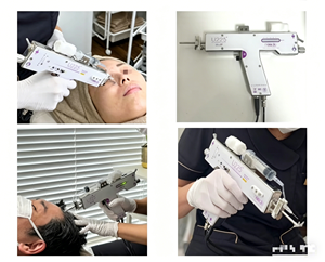 Inyector de <span class=keywords><strong>Mesoterapia</strong></span> U225 Mesogun 2 en 1 con Certificación CE, Dispositivo Portátil para el Cuidado <span class=keywords><strong>Facial</strong></span> y del Cuero Cabelludo, Directo de Fábrica, 1 Año de Garantía - Product Image 2
