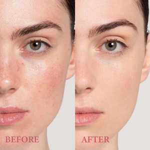 โทนเนอร์ฉีดพ่นน้ำกุหลาบ แบรนด์ส่วนตัว ผสมวิชฮาเซล บำรุงผิวหน้า ช่วยควบคุมความมัน ให้ความชุ่มชื้น - Product Image 4