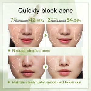 เซรั่มน้ำมันทีทรีออร์แกนิคแบรนด์ส่วนตัวสำหรับลดสิวและรอยแดง 30 มล. - Product Image 5