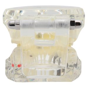<span class=keywords><strong>Prix</strong></span> usine Transparent <span class=keywords><strong>adulte</strong></span> pathologie dentaire dents modèle prothèse modèle d'enseignement modèle dents - Product Image 6