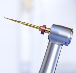 <span class=keywords><strong>Motor</strong></span> <span class=keywords><strong>Endo</strong></span> dental inalámbrico con pieza de mano de terapia de conducto radicular de velocidad ajustable - Product Image 5