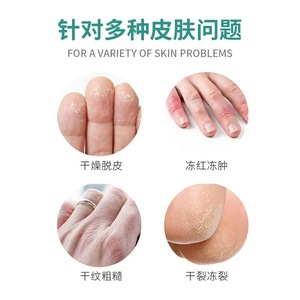 ครีมบำรุงผิวอูเรีย วิตามินอี ซีฉี เม่ยหลง 50 กรัม/หลอด ครีมอูเรีย วิตามินอี - Product Image 2