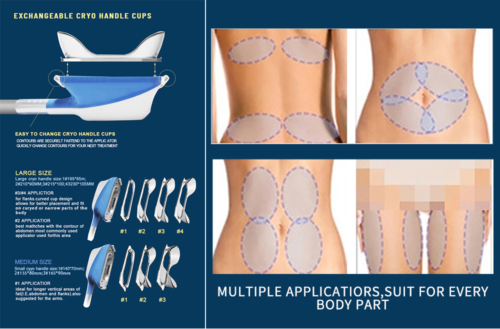 cryo360 cryolipolysis machine price/fat removal machine cryolipolysis slimming machine fat freezing