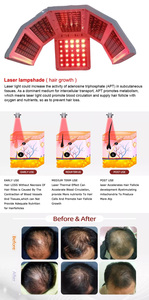 Analyseur vertical de soin du cuir chevelu, instrument de test, détection des follicules pileux, équipement de salon de beauté - Product Image 5