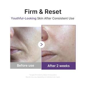 Suero Facial Antienvejecimiento Medicube Retinol Boosting Serum 1.9% Retinol-Some 30ml - Product Image 4