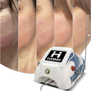 New Arrival Diode <strong>Laser</strong> 980 nm Spider Vein Removal Blood Vessels Removal Fungus Nail Fungus <strong>Treatment</strong> Machine for Beauty Salon - Product Image 6