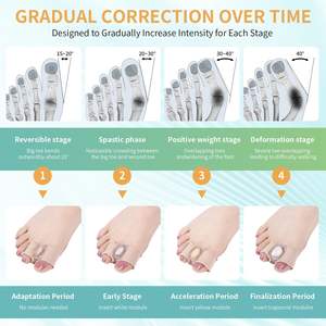 Penyangga Jari Kaki Silikon Gel, Pemisah Bunion, Penyangga Hallux Valgus, Pelurus Jari Kaki, Ortosis untuk Jari Kaki Bertumpuk, Pereda Nyeri - Product Image 2