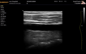 Laptop Full Digital Ultrasound Scanners Ultrassom Portátil Doppler Colorido - Product Image 6