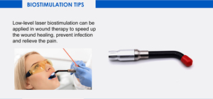 Máquina de Láser <span class=keywords><strong>Dental</strong></span> de Diodo a <span class=keywords><strong>Precio</strong></span> de Fábrica, Equipos Dentales, Láser <span class=keywords><strong>Dental</strong></span> Inalámbrico Portátil, Accesorio - Product Image 6