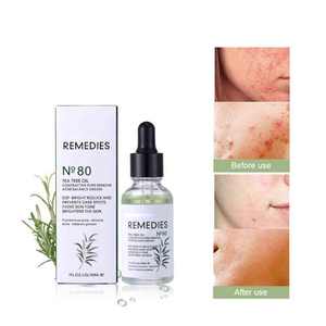 Aceite de Árbol de Té <span class=keywords><strong>para</strong></span> Eliminar el Acné, Esencia de Aceite <span class=keywords><strong>Astringente</strong></span> <span class=keywords><strong>para</strong></span> Evitar Manchas, Equilibrar el Tono DE LA <span class=keywords><strong>Piel</strong></span> y Calmar La Esencia DE LA <span class=keywords><strong>Piel</strong></span>, 30ml - Product Image 1