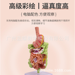 Modelo patológico del colon humano, modelo anatómico gastrointestinal, modelo patológico de colon, cecum, recto y duodeno - Product Image 4
