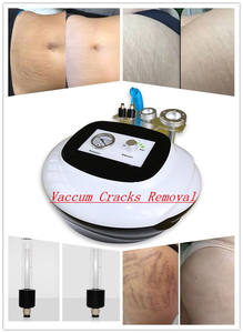 Masseur à ventouses pour le drainage lymphatique et la cellulite corporelle, utilisé en spa médical, avec prix promotionnel en stock - Product Image 5