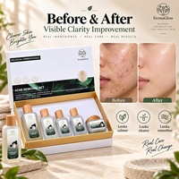 Kit de Soins Cutanés Purifiants et Anti-Acné à l'Acide Salicylique Fermenté, au Théier et au Thé Vert pour le Contrôle du Sébum et l'Élimination des Boutons