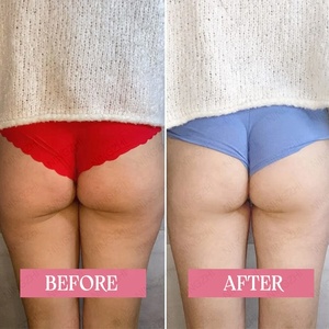 Hot bán 100g chiến lợi phẩm Plumping mặt nạ thảo dược nuôi dưỡng và định hình cơ thể <span class=keywords><strong>nask</strong></span> - Product Image 6