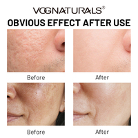 Gouttes lumineuses de pastèque 5% Niacinamide pour peau de verre instantanée Pastèque pour l'hydratation Minimiser les pores