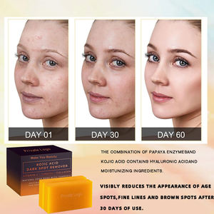 Sapone Naturale OEM per la Cura della Pelle, Correttore di Macchie Scure, Schiarente e Idratante, Fatto a Mano con Curcuma e Acido Kojico per Viso e Corpo - Product Image 3