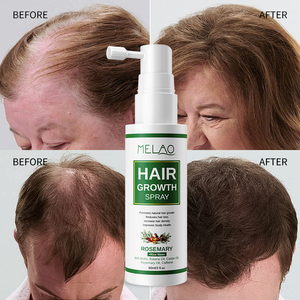 Spray Capilar Ligero con Fórmula Orgánica Personalizada para Nutrir el Cuero Cabelludo y Estimular el Crecimiento del Cabello Fino - Product Image 6