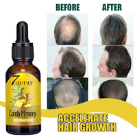 Prix d'usine – Sérum de croissance capillaire au gingembre en 7 jours – Extrait végétal naturel – Renforce les racines des cheveux – Huile de croissance capillaire pour cheveux clairsemés
