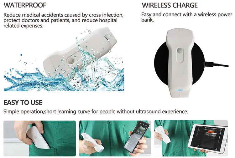 Sonda de ultrasonido inalámbrica Wifi y USB 3 en 1 portátil de mano más rentable