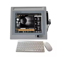 Retiwave-1000 Appareil d'échographie ophtalmique portable A/B Scan pour la biométrie et les examens oculaires en ophtalmologie
