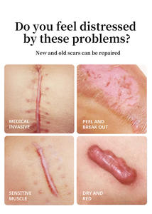 Ungüento MAYCHEER para la Decoloración de la Piel Postoperatoria por Quemaduras - Product Image 3