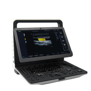 MSLCU77 컬러 도플러 초음파는 소노스케이프 E3 초음파 스캐너와 유사합니다. - Product Image 1