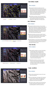 Scalp Analyzer & Head Massager with Scalp Analysis and Scalp Care Functions Commercial Salon Equipment Home Use Skin Analyzer - Product Image 6