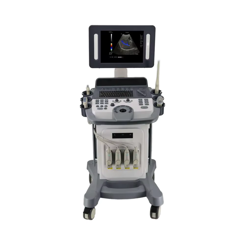 HOCHEY Medical Ultrasound Instruments Portable 4d