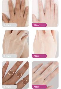 <span class=keywords><strong>Masque</strong></span> de beauté pour les <span class=keywords><strong>mains</strong></span> RtopR à la <span class=keywords><strong>mangue</strong></span>, réduit les rides des <span class=keywords><strong>mains</strong></span>, hydrate et éclaircit, anti-âge - Product Image 6