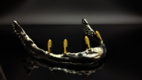Impresora 3D Dental SLM de Alta Velocidad, Máquina de Fabricación Aditiva Industrial por Fusión Selectiva Láser de Metal